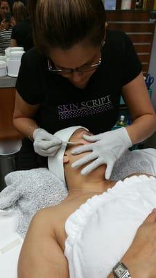 Dermaplaning uses a fine blade that removes dead skin cells, vellous hair and helps with hyperpigmentation.