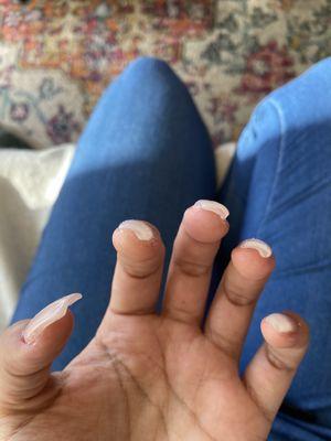 Lumpy nails