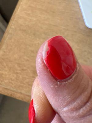 Chipped nail, damaged cuticles