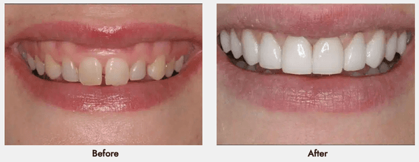 Smile by Design Dental Group