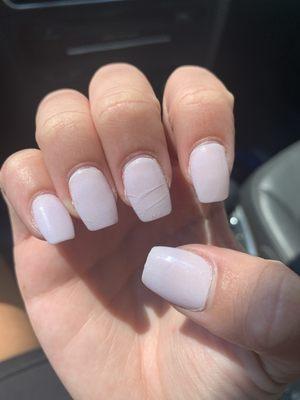 cracked and chipped nails