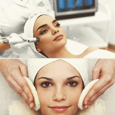 Holidays special!! Get ready for Christmas and New Years full Facial and Microdermabrasion $ 120,00