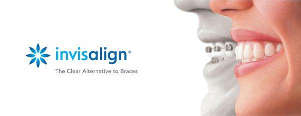 We offer Invisalign