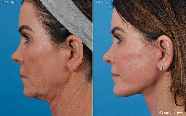 Ponsky Facial Plastic Surgery