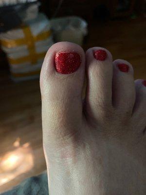 Bad pedicure