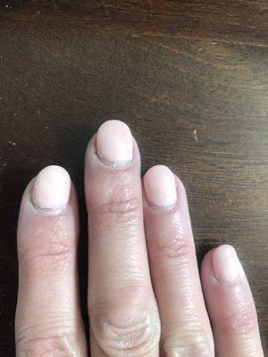 Less than a week- lifting on all edges!! Nails are not even shaped symmetrically! Dip all over cuticles too!