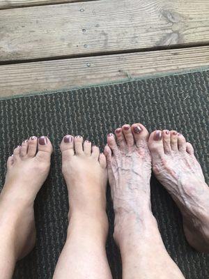 Our beautiful painted toes