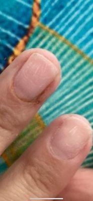 Dremel Scratches on nail