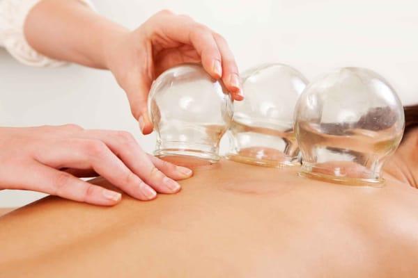 Cupping encourages circulation of blood and sedation of the nervous system. It works wonders on the tight muscles of the back and shoulders.