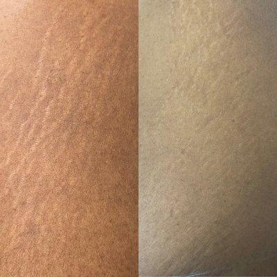 Stretch marks Inkless