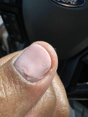 Lumpy nail polish.