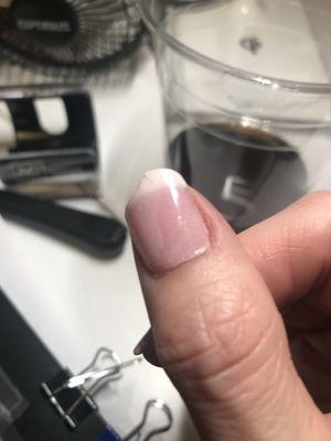 You can see the line through the nail where she didn't apply the powder correctly and tried to fix it, then it broke due to thinning.