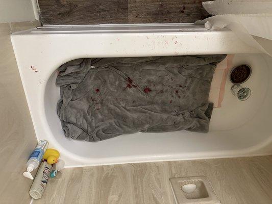 The bloody bath tub where he was laying