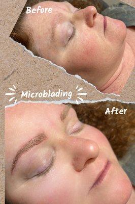 Brow microblading