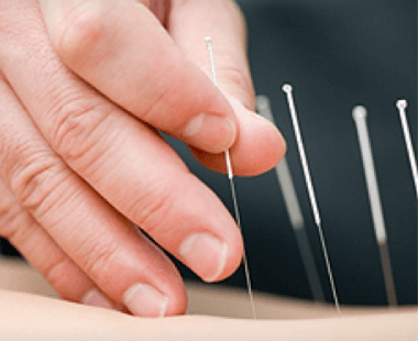 Manayunk Roxborough Community Acupuncture