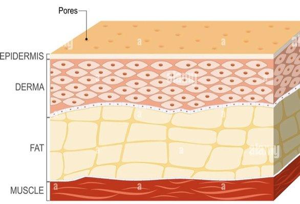 Layers of Skin...Laser Lipolysis breaks down your top 3 layers of your skin; no needles, no scalpel and no stitches...non-invasive treatment