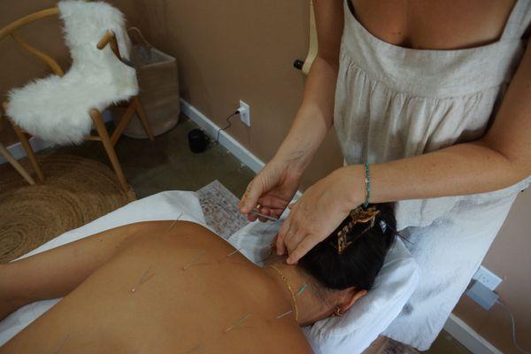 Acupuncture for neck and back pain