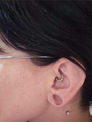 My 3/4" guaged ear, pre-surgery