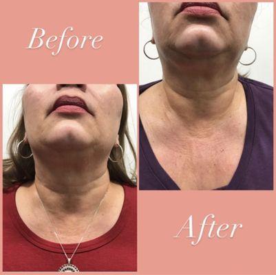 Face, Neck, and Body Treatments