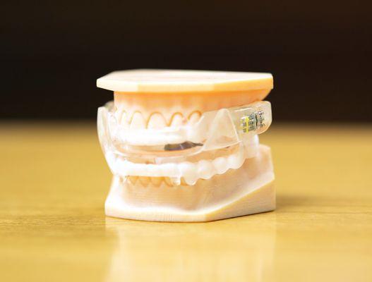 Oral Appliance Therapy