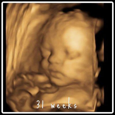 31 weeks