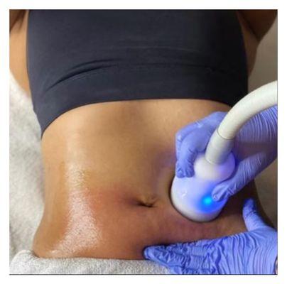 Cryo slimming uses heat then cold to destroy fat which is flushed out by the lymphatic system over 14 days.