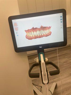 Scan of my teeth