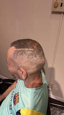 Skin fade, high and tight, razor part