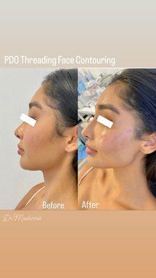 PDO Threading Face Contouring