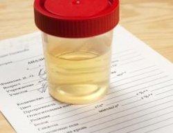 Urine Drug Testing Personal - Court - Company - DOT