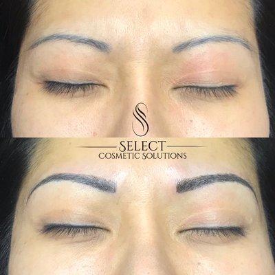 Tattoo correction - microblading