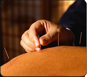 EW Natural Healing Acupuncture PC