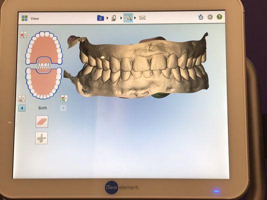 My smile in 3D with their scanners