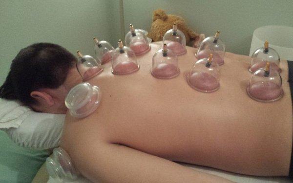 Had an awesome deep tissue massage and cupping session at austin acupressure. Was intense, but felt amazing afterwards.