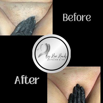 Waxing Hair Removal