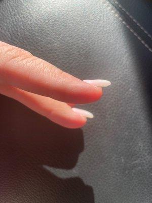 Uneven thick SNS nail