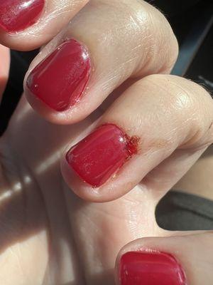 Bloody nails