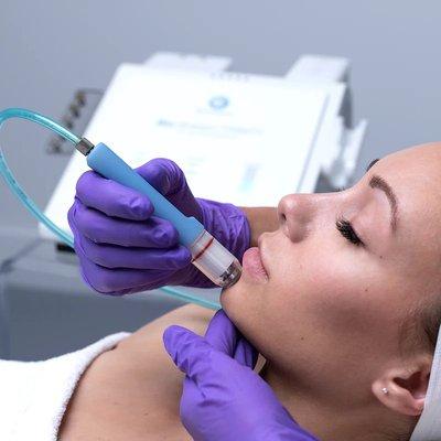 MICRODERM facial treatment featuring the Bio-Brasion Trinity Microdermabrasion machine