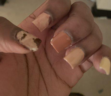 See nails peeling here.