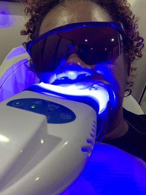 Teeth Whitening