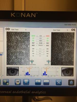 Corneal analyzer for dry eye, allergies, and red eyes.