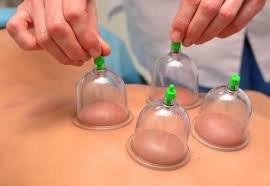 Cupping is a method used to release deep fascial restrictions and adhesions, promoting healing. Leads to less pain and restriction