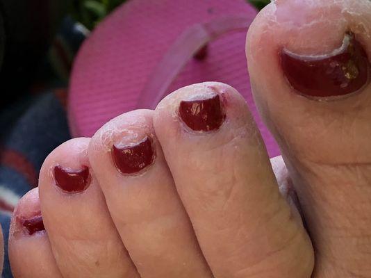 My foot, 2 hrs after pedicure