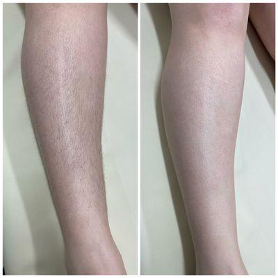 Before and after leg wax