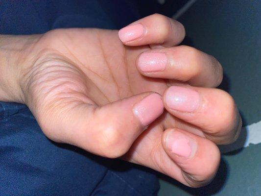 So this is the updated photo! Literally this gel manicure did last 2 freakin days! Very disappointed!