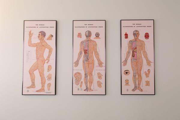 Fancy acupuncture posters