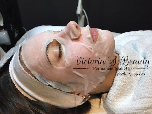 Collagen vitamin mask right after microneedling treatment