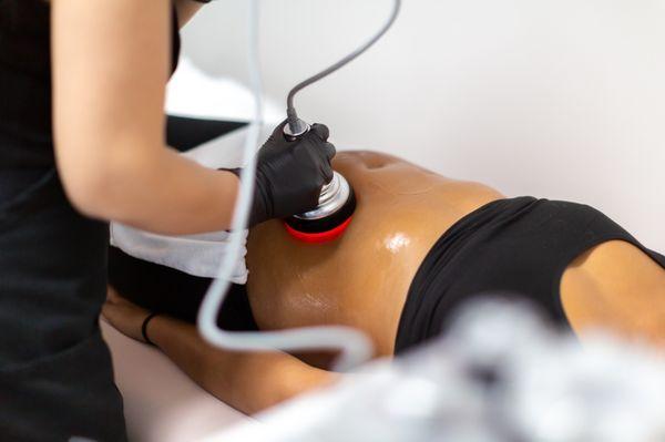 Lipo Cavitation