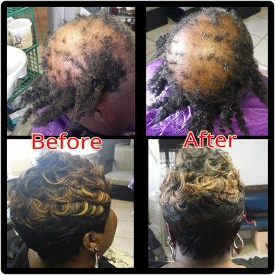 Non Surgical Hair Replacement