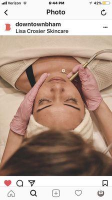 Microdermabrasion- great skin starts here!